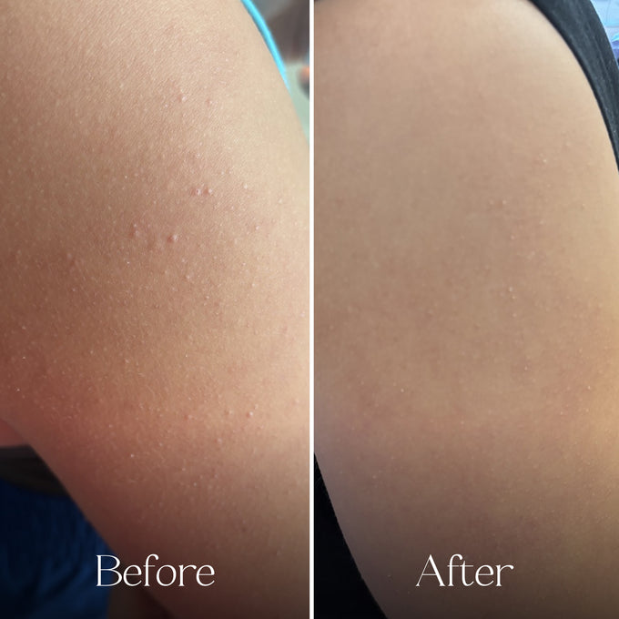 Everist-The Everist Holiday Bonbon-Body-TheDetoxMarket_PDP_Holiday_BonBon7-The Detox Market | 