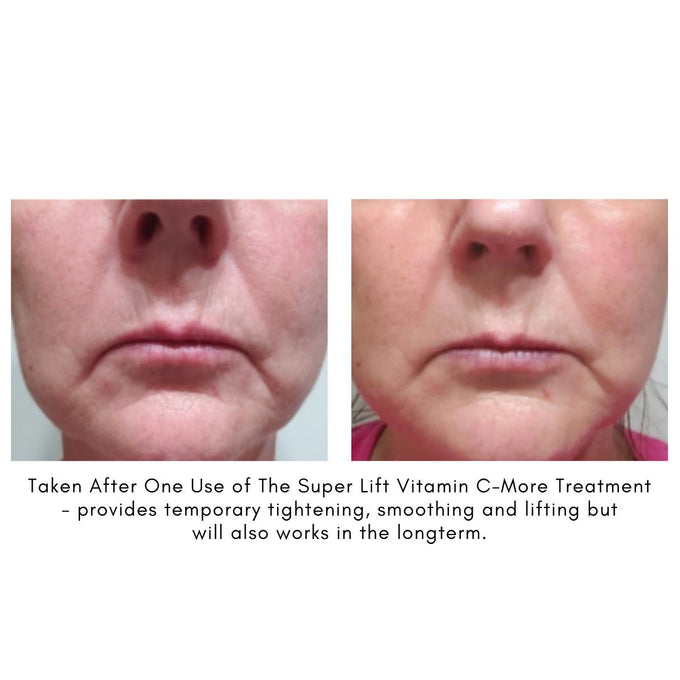 Maya chia-The Super Lift Vitamin C-More Treatment-