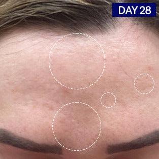 Odacite-Salicylic + Hyaluronic Acid Clarifying Serum-