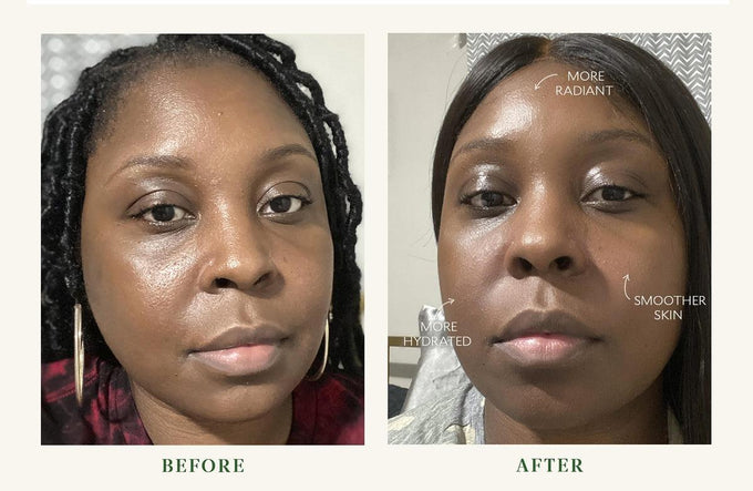 Tata Harper-Fortifying Moisturizer-